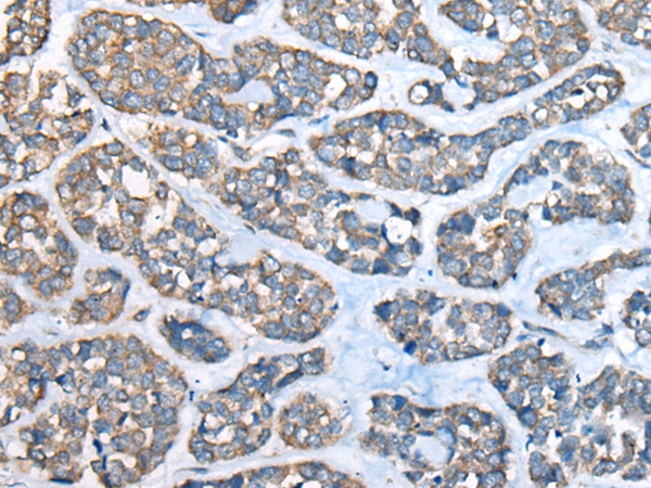 GULP1 Antibody[46570]
