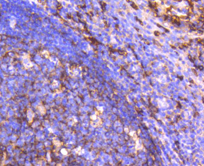 CD14 Rabbit mAb[49003]