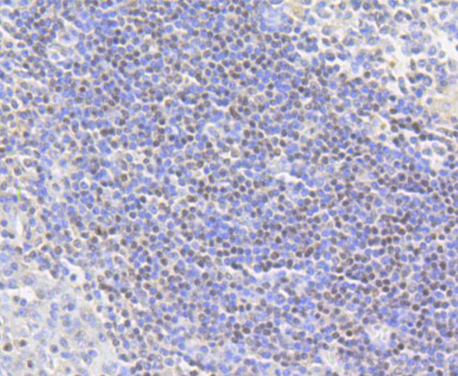 Histone H2A(acetyl K9) Rabbit