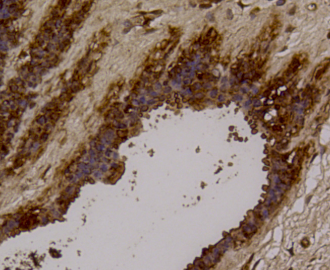 Metadherin(LYRIC) Antibody[482