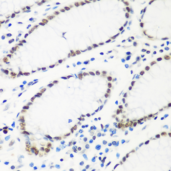 HTATSF1 Polyclonal Antibody[30