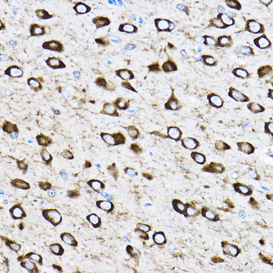 RPL17 Polyclonal Antibody[3068