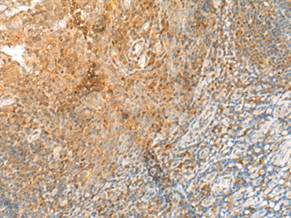 GPR89A/GPR89B Antibody[47781]