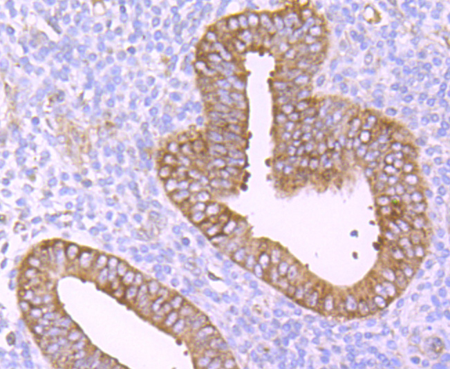 TNF Receptor II Rabbit mAb[494
