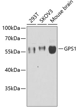GPS1 Polyclonal Antibody[30757