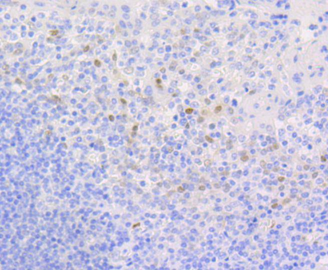 Cyclin D1 Rabbit mAb[48619]