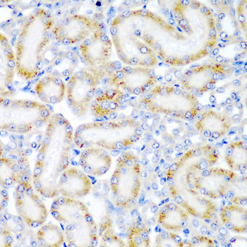 WRB Polyclonal Antibody[30787]