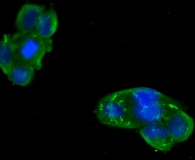 Metadherin(LYRIC) Antibody[482