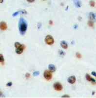 NOM1 Antibody[47900]