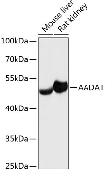 AADAT Polyclonal Antibody[2789