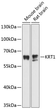 KRT1 Polyclonal Antibody[27581