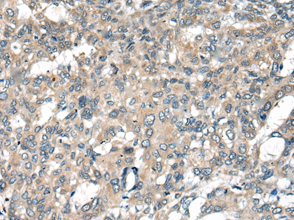 ACKR2 Antibody[46304]