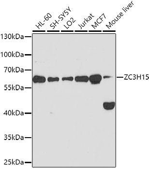 ZC3H15 Polyclonal Antibody[272