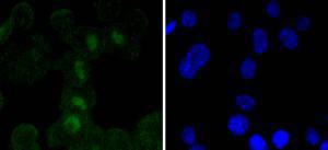 SOX11 Rabbit mAb[49190]