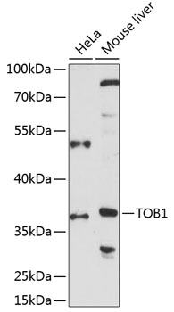 TOB1 Polyclonal Antibody[28721