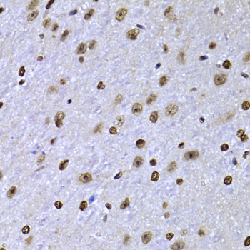 SOX5 Polyclonal Antibody[30782