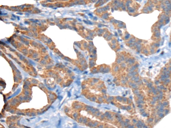 RTN4IP1 Antibody[46663]