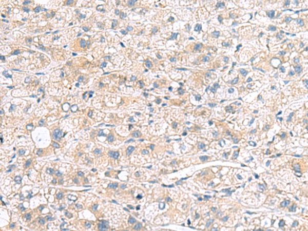 MYL1 Antibody[47440]