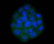 SOX10 Rabbit mAb[49193]