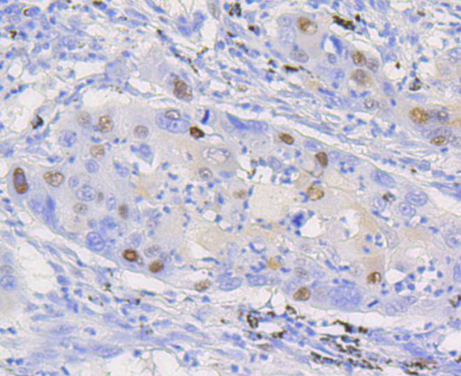 Cyclin D1 Rabbit mAb[48619]