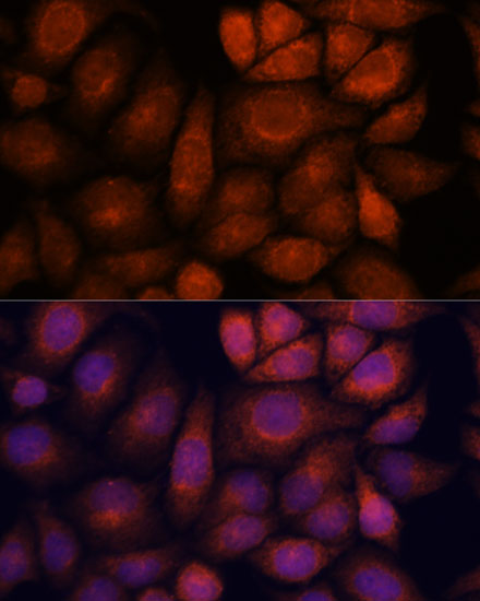 KIF13A Polyclonal Antibody[294