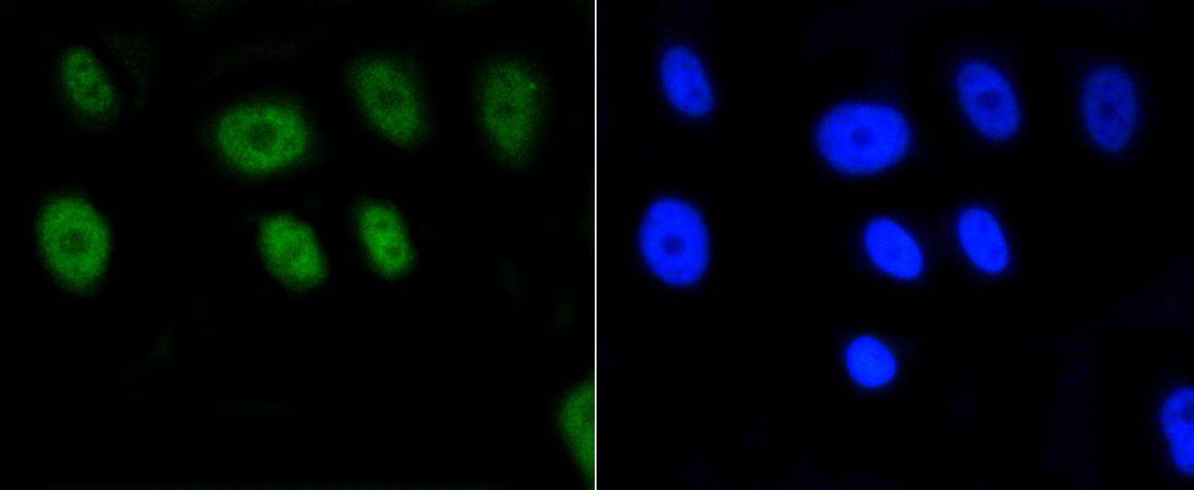 Histone H2A(acetyl K9) Rabbit