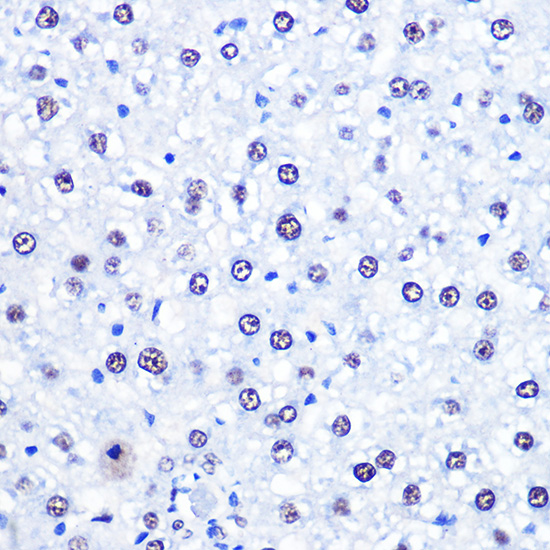 CHD4 Polyclonal Antibody[29086