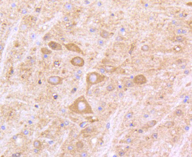 IFNAR1 Rabbit mAb[48656]