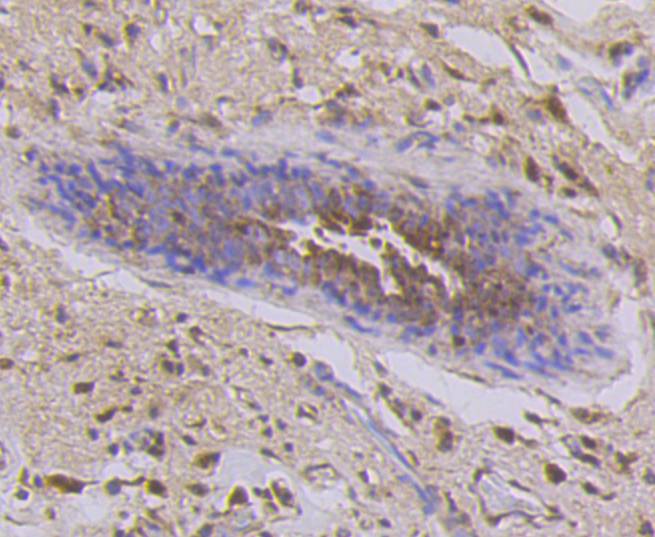 Cytokeratin 7 Rabbit mAb[48899