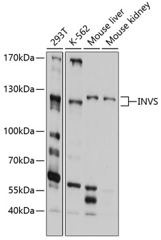 INVS Polyclonal Antibody[27359