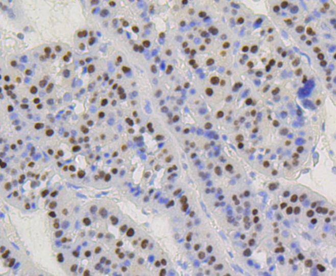 Cyclin D1 Rabbit mAb[48619]