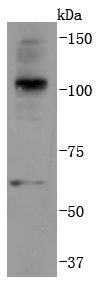 K63-linkage Specific Ubiquitin