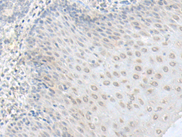 RPS27L Antibody[47263]
