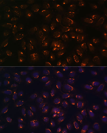 GALNT2 Polyclonal Antibody[307