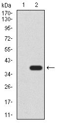 CK5 Antibody[48387]