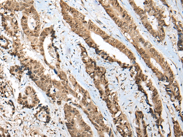 CITED1 Antibody[46504]