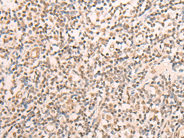 CELF2 Antibody[46949]