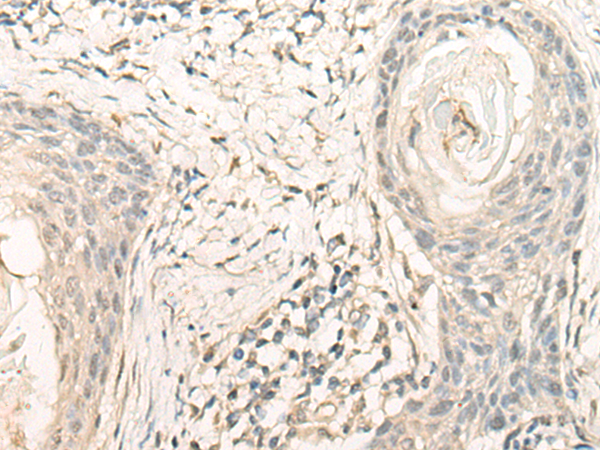 NUBP2 Antibody[47172]