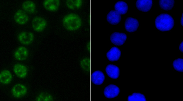 PABPN1 Rabbit mAb[49479]