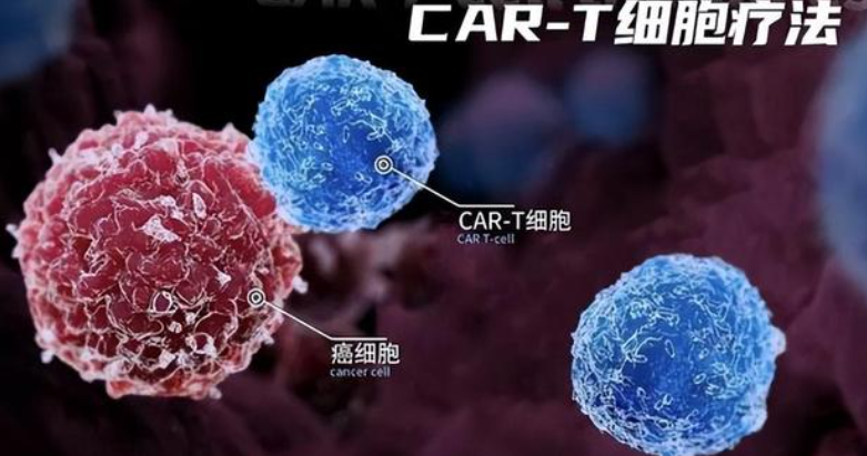 CAR-T细胞疗法：现状、挑战与未来演进