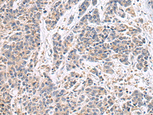 COX7A2 antibody[31973]