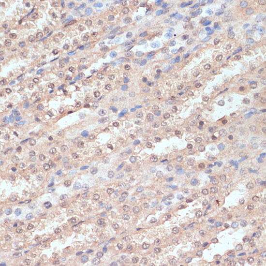 NAA20 Polyclonal Antibody[3082