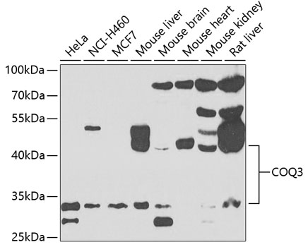 COQ3 Polyclonal Antibody[30937