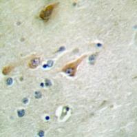 NT5C3 Antibody[47841]