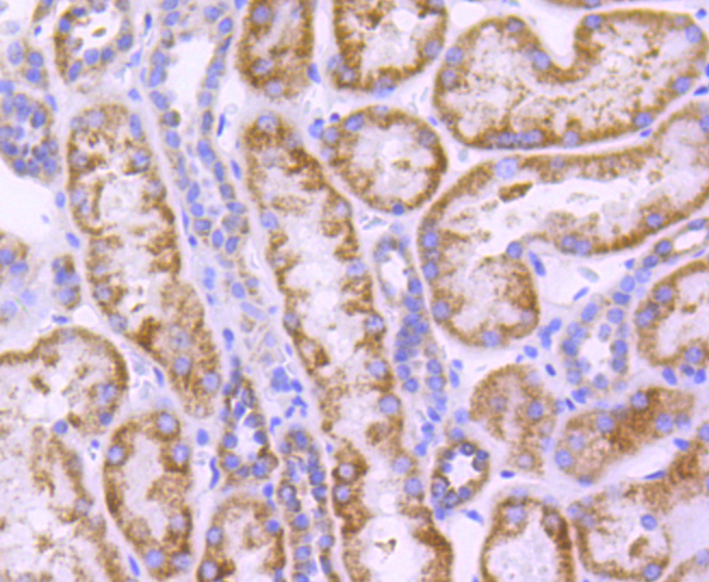 CPT2 Rabbit mAb[49079]
