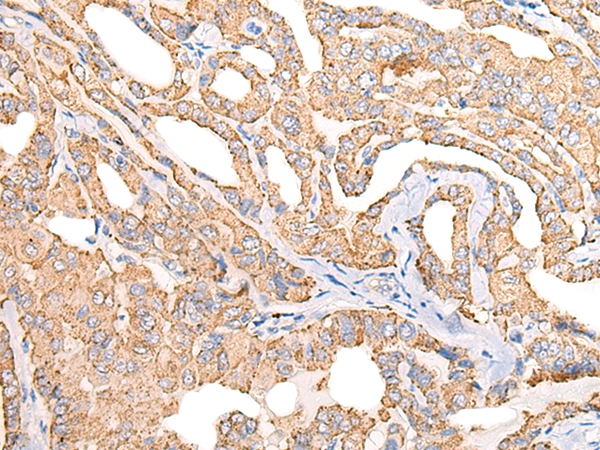 COPS8 Antibody[46535]