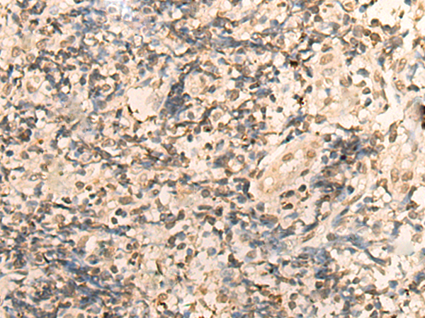 DDX50 Antibody[47041]