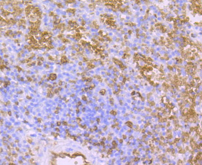 AQP1 Rabbit mAb[49447]
