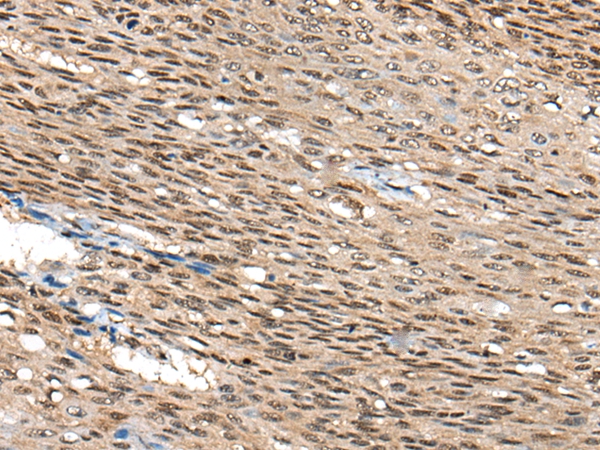 CITED1 Antibody[46504]