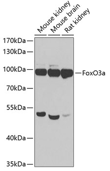 FoxO3a Polyclonal Antibody[290